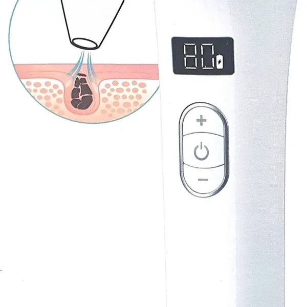 Sanitas SFC 35 aspiratore pori vista frontale con display LED e schema funzionamento vacuum